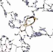 Detection of LYVE-1 in endothelial cells of human lung blood vessels. ECL detection overnight.