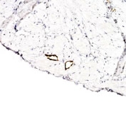 Detection of LYVE-1 in endothelial cells of human bladder vasculature. ECL detection overnight.
