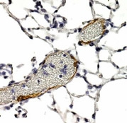 Detection of LYVE-1 in endothelial cells of human lung blood vessels. ECL detection overnight.