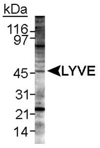 Detection of LYVE-1 in mouse spleen lysate. ECL detection overnight.