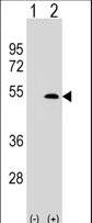 Western blot of XLKD1 (arrow) using rabbit polyclonal XLKD1 Antibody (C61). 293 cell lysates (2 ug/lane) either nontransfected (Lane 1) or transiently transfected (Lane 2) with the XLKD1 gene.