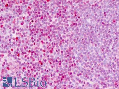 Human Tonsil: Formalin-Fixed, Paraffin-Embedded (FFPE)