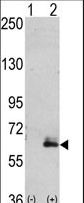 Western blot of hMAP2-Q425 (arrow) using rabbit polyclonal hMAP2-Q425 Antibody (RB02868). 293 cell lysates (2 ug/lane) either nontransfected (Lane 1) or transiently transfected with the hMAP2-Q425 gene (Lane 2) (Origene Technologies).