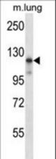 Mouse Map3k14 Antibody western blot of mouse lung tissue lysates (35 ug/lane). The Map3k14 antibody detected the Map3k14 protein (arrow).