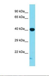 Western blot of Mouse Brain. Mapk1 antibody dilution 1.0 ug/ml.
