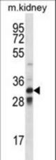 TLX1 Antibody western blot of mouse kidney tissue lysates (35 ug/lane). The TLX1 antibody detected the TLX1 protein (arrow).