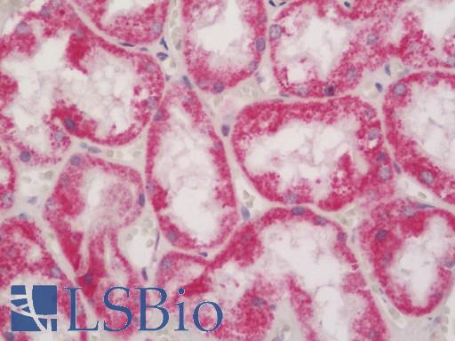 Human Kidney: Formalin-Fixed, Paraffin-Embedded (FFPE)