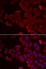 Immunofluorescence analysis of U2OS cell using MARCKSL1 antibody. Blue: DAPI for nuclear staining.