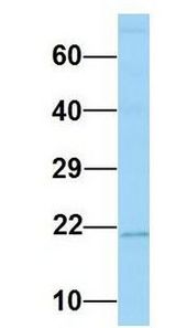 MARCKSL1 / MRP antibody Western Blot of Human Fetal Lung. Antibody Dilution: 1.0 ug/ml. Antibody dilution: 1 ug/ml.