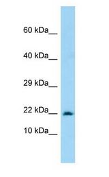 MARCKSL1 / MRP antibody Western Blot of 293T.