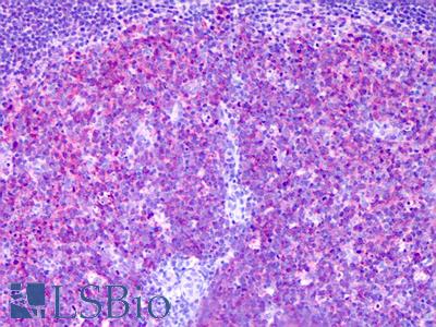 Anti-MARCKSL1 / MRP antibody IHC of human tonsil, germinal center. Immunohistochemistry of formalin-fixed, paraffin-embedded tissue after heat-induced antigen retrieval. Antibody LS-B6354 concentration 5 ug/ml.
