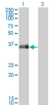 Western blot of MARCKSL1 expression in transfected 293T cell line by antibody LS-B6354.