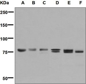 Western blot analysis on (A) Raw 264.7, (B) NIH/3T3, (C) Neuro-2a, (D) Jurkat, (E) Raji, and (F) U87-MG cell lysates using anti-MARK2 antibody.