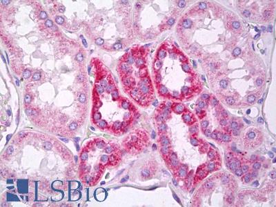 Anti-MARK2 antibody IHC of human kidney, tubules. Immunohistochemistry of formalin-fixed, paraffin-embedded tissue after heat-induced antigen retrieval. Antibody LS-B7503 concentration 10 ug/ml.