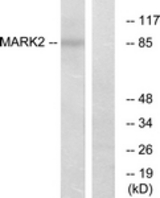 Western blot of extracts from COS7 cells, using MARK2 Antibody. The lane on the right is treated with the synthesized peptide.