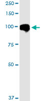 MARK2 monoclonal antibody (M01), clone 3B12. Western Blot analysis of MARK2 expression in A-431.