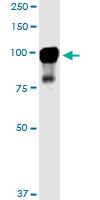 MARK2 monoclonal antibody (M01), clone 3B12. Western Blot analysis of MARK2 expression in PC-12.