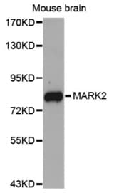 Western blot analysis of extracts of Mouse brain cell lines, using MARK2 antibody.