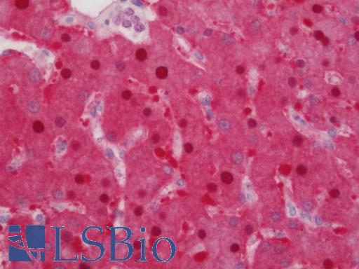 Human Liver: Formalin-Fixed, Paraffin-Embedded (FFPE)