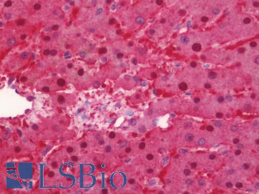 Anti-MAT2A antibody IHC staining of human liver. Immunohistochemistry of formalin-fixed, paraffin-embedded tissue after heat-induced antigen retrieval. Antibody LS-B10931 concentration 5 ug/ml.