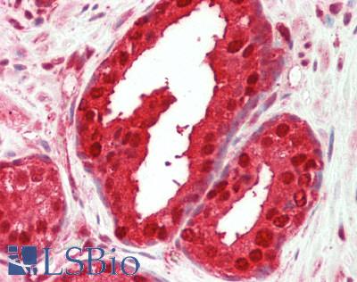 Human Prostate: Formalin-Fixed, Paraffin-Embedded (FFPE)