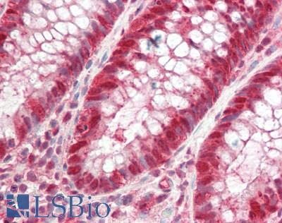 Human Colon: Formalin-Fixed, Paraffin-Embedded (FFPE)