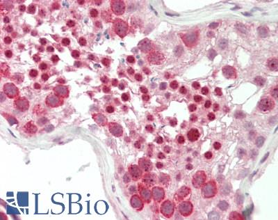 Human Testis: Formalin-Fixed, Paraffin-Embedded (FFPE)