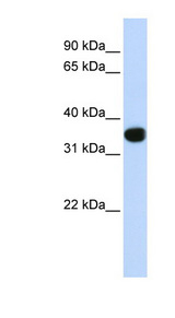 TLX1 antibody LS-C112331 Western blot of Fetal Heart lysate.