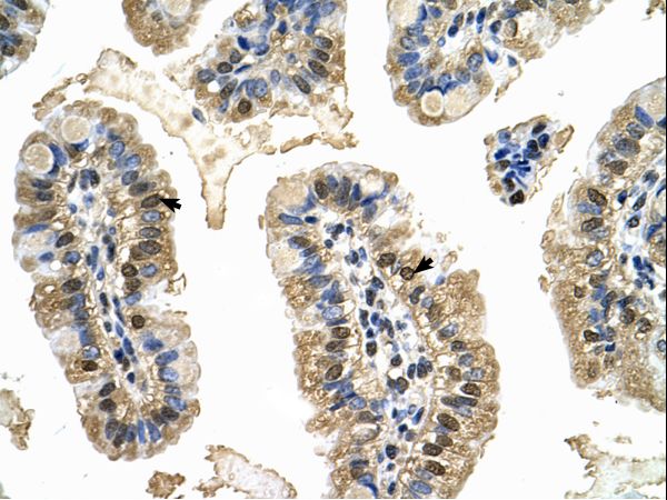 MCM8 antibody LS-C80163 was used in IHC to stain formalin-fixed, paraffin-embedded human intestine.