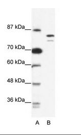 A: Marker, B: Jurkat Cell Lysate