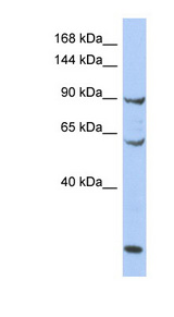 MCM8 antibody LS-C110194 Western blot of OVCAR-3 cell lysate.