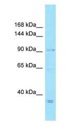 MCPH1 / MCT antibody Western Blot of HeLa.