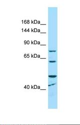 Western blot of Human Hela. MCPH1 antibody dilution 1.0 ug/ml.
