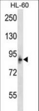 MCPH1 Antibody western blot of HL-60 cell line lysates (35 ug/lane). The MCPH1 antibody detected the MCPH1 protein (arrow).