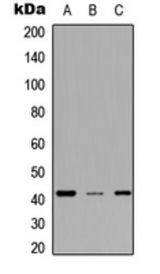 Western blot analysis of MESP2 expression in A549 (A); NS-1 (B); H9C2 (C) whole cell lysates.
