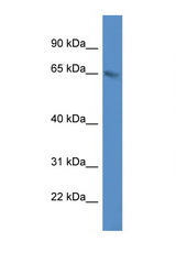 METTL3 antibody LS-C134988 Western blot of HepG2 Cell lysate. Antibody concentration 1 ug/ml.