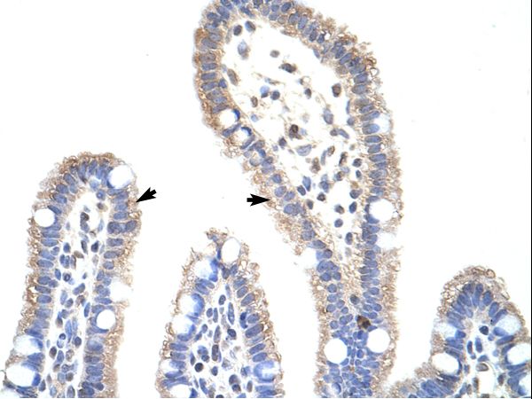 METTL3 antibody LS-C31298 was used in IHC to stain formalin-fixed, paraffin-embedded human intestine.