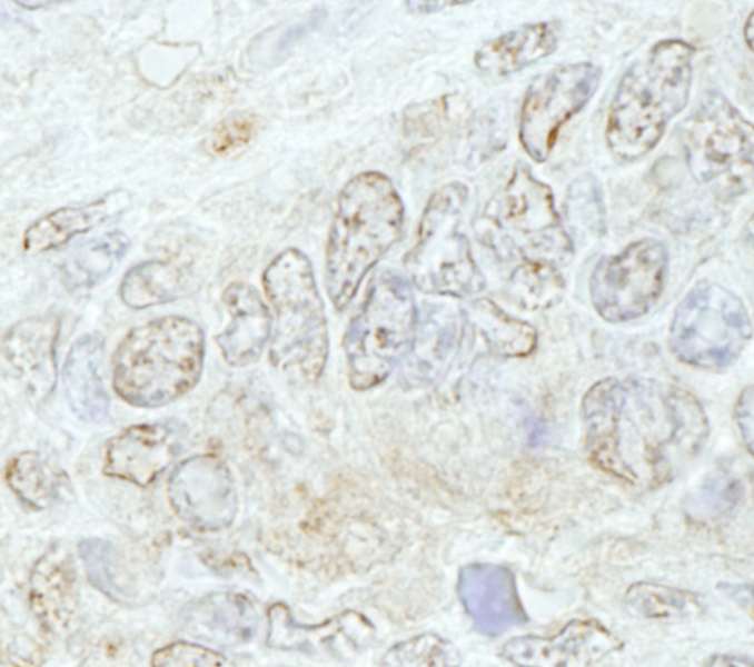 Detection of Mouse METTL3/MT-A70 by Immunohistochemistry. Sample: FFPE section of mouse teratoma. Antibody: Affinity purified rabbit anti-METTL3/MT-A70 used at a dilution of 1:100.