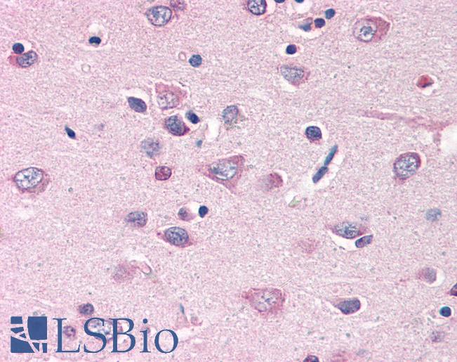 Anti-MFI2 antibody LS-A9849 IHC of human brain, cortex. Immunohistochemistry of formalin-fixed, paraffin-embedded tissue after heat-induced antigen retrieval.