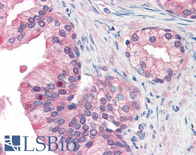 Anti-MFI2 antibody LS-A9849 IHC of human prostate. Immunohistochemistry of formalin-fixed, paraffin-embedded tissue after heat-induced antigen retrieval.