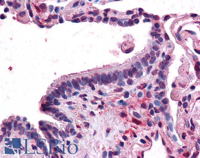 Anti-MFI2 antibody LS-A8346 IHC of human lung, respiratory epithelium. Immunohistochemistry of formalin-fixed, paraffin-embedded tissue after heat-induced antigen retrieval.