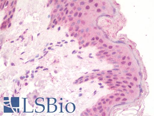 Anti-TLX1 / HOX11 antibody IHC staining of human skin. Immunohistochemistry of formalin-fixed, paraffin-embedded tissue after heat-induced antigen retrieval. Antibody LS-B10109 concentration 10 ug/ml.