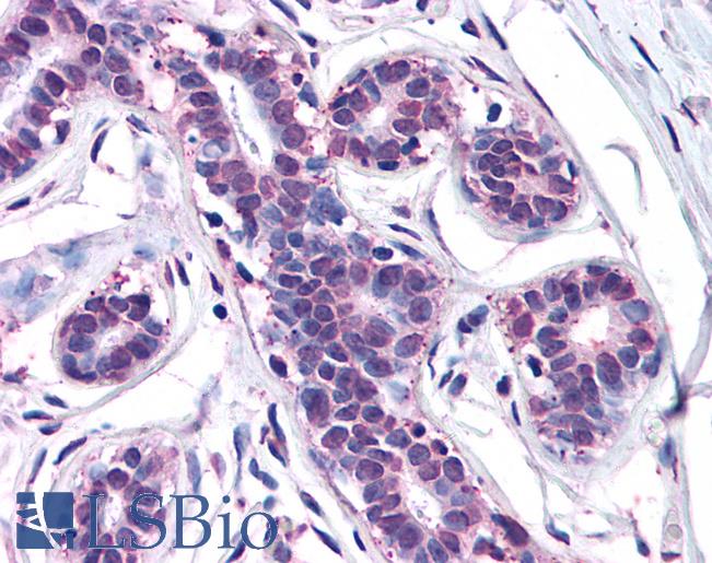 Anti-MFI2 antibody LS-A8346 IHC of human breast. Immunohistochemistry of formalin-fixed, paraffin-embedded tissue after heat-induced antigen retrieval.