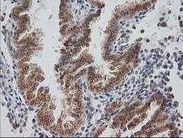 IHC of paraffin-embedded Human endometrium tissue using anti-MGLL mouse monoclonal antibody. (Heat-induced epitope retrieval by 10mM citric buffer, pH6.0, 100C for 10min).