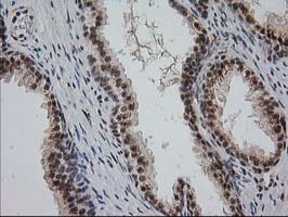 IHC of paraffin-embedded Human prostate tissue using anti-MGLL mouse monoclonal antibody. (Heat-induced epitope retrieval by 10mM citric buffer, pH6.0, 100C for 10min).