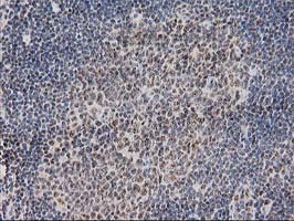 IHC of paraffin-embedded Human lymph node tissue using anti-MGLL mouse monoclonal antibody. (Heat-induced epitope retrieval by 10mM citric buffer, pH6.0, 100C for 10min).