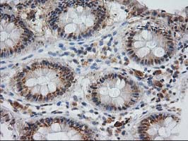 IHC of paraffin-embedded Human colon tissue using anti-MGLL mouse monoclonal antibody. (Heat-induced epitope retrieval by 10mM citric buffer, pH6.0, 100C for 10min).