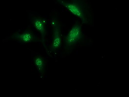 Immunofluorescent staining of HeLa cells using anti-MGLL mouse monoclonal antibody.