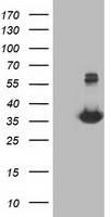HEK293T cells were transfected with the pCMV6-ENTRY control (Left lane) or pCMV6-ENTRY MGLL (Right lane) cDNA for 48 hrs and lysed. Equivalent amounts of cell lysates (5 ug per lane) were separated by SDS-PAGE and immunoblotted with anti-MGLL.