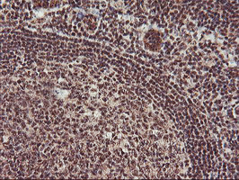 IHC of paraffin-embedded Human tonsil using anti-MGLL mouse monoclonal antibody.